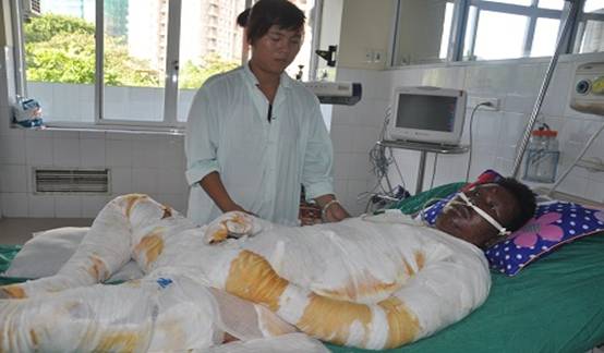  Caritas Bui Chu conducts charity visits to burn patients